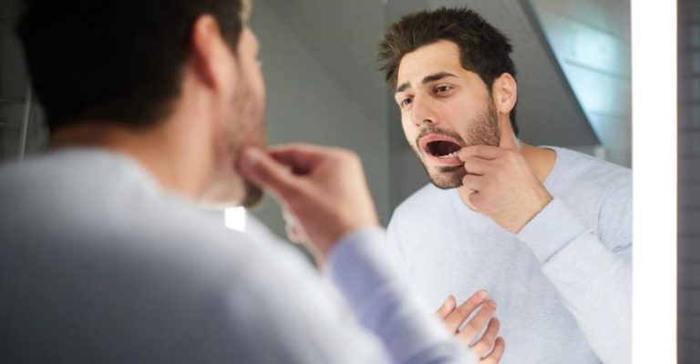 വായിലെ അര്‍ബുദം പലതരം; ലക്ഷണങ്ങള്‍ ഇവ