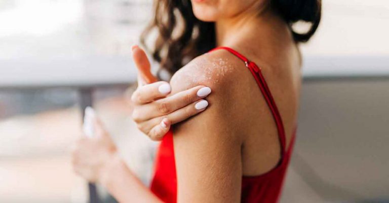 പ്രമേഹം ചര്‍മത്തെ ബാധിക്കുന്നത് ഇങ്ങനെയെല്ലാം