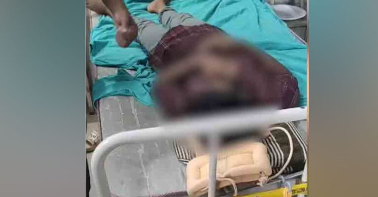 ഉരുട്ടിക്കളിച്ച ടയര്‍ ദേഹത്ത് തട്ടി; മലപ്പുറത്ത് പതിനൊന്നുകാരന് ക്രൂരമര്‍ദനം